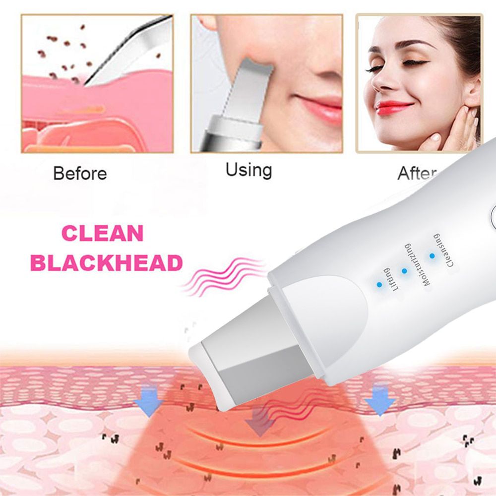 Blackhead Remover Electric Deep Facial Cleansing Ance Remover Pimple Black Head Remover Machine Skin Scrubber Nano Pore Cleaner
