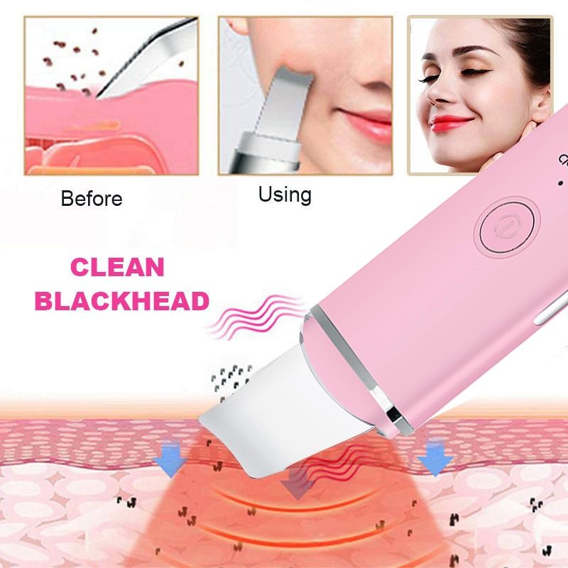 Ultrasonic Skin Scrubber Facial Pore Cleaner Ion Acne Blackhead Remover Peeling Shovel Cleaner Facial Massager Face Lift Machine